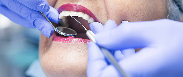 Best Emergency Dental Services for Seniors in Ferndale, MI